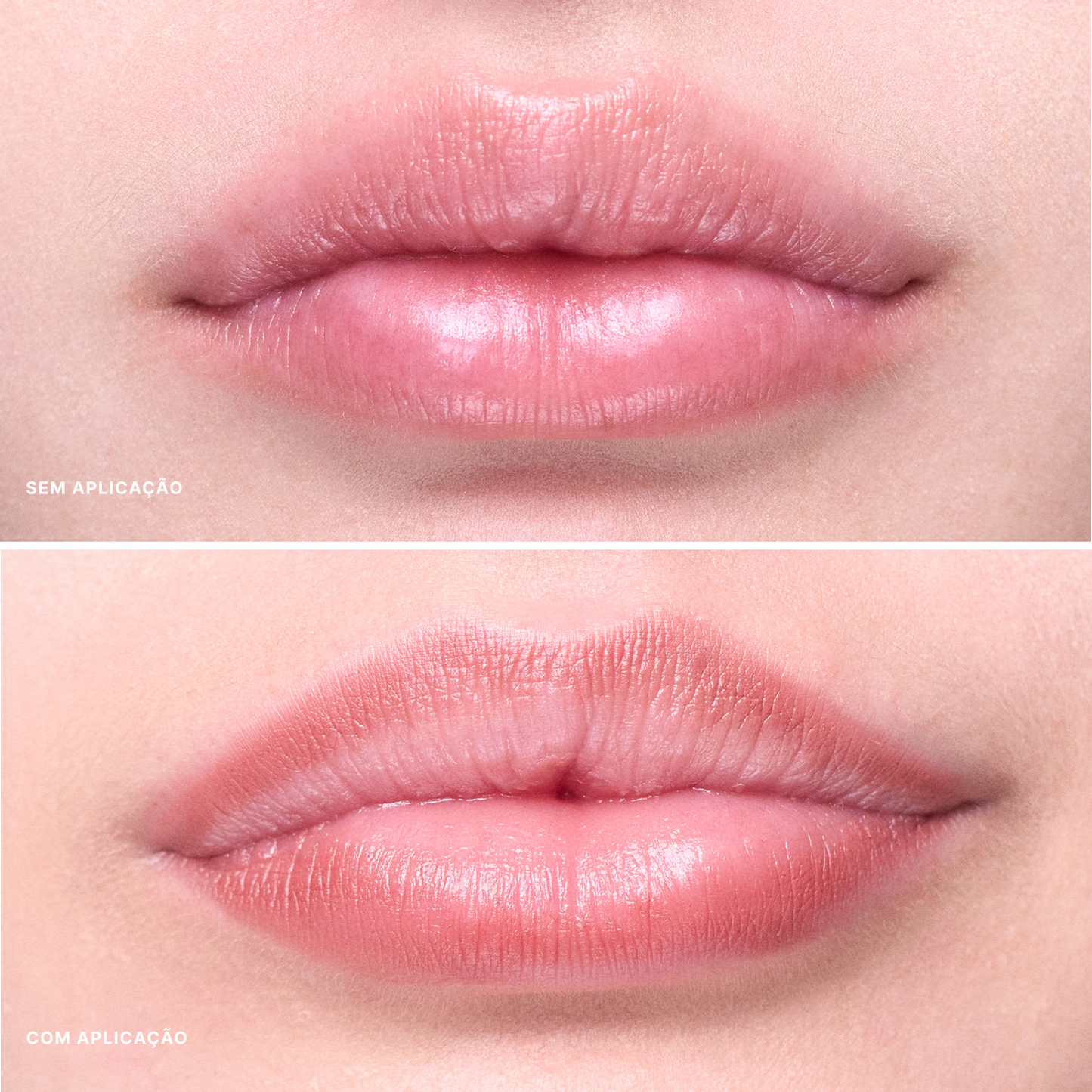 Contorno Labial